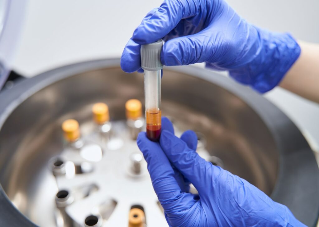 woman prepearing for medical research with centrif 2023 11 27 05 05 04 utc